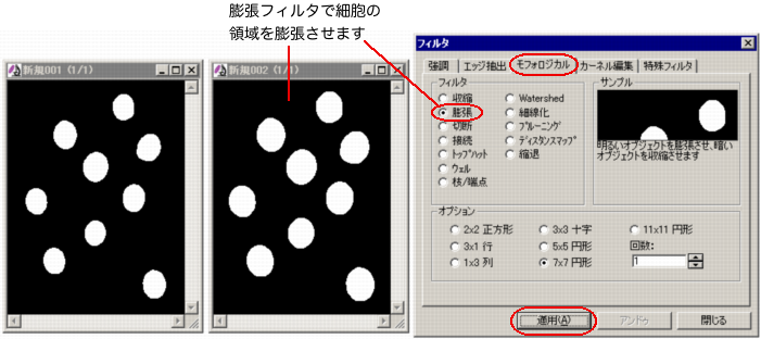 細胞領域を膨張させる